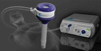 Image: The SurgiQuest AirSeal iFS and Access Port (Photo courtesy of SurgiQuest).